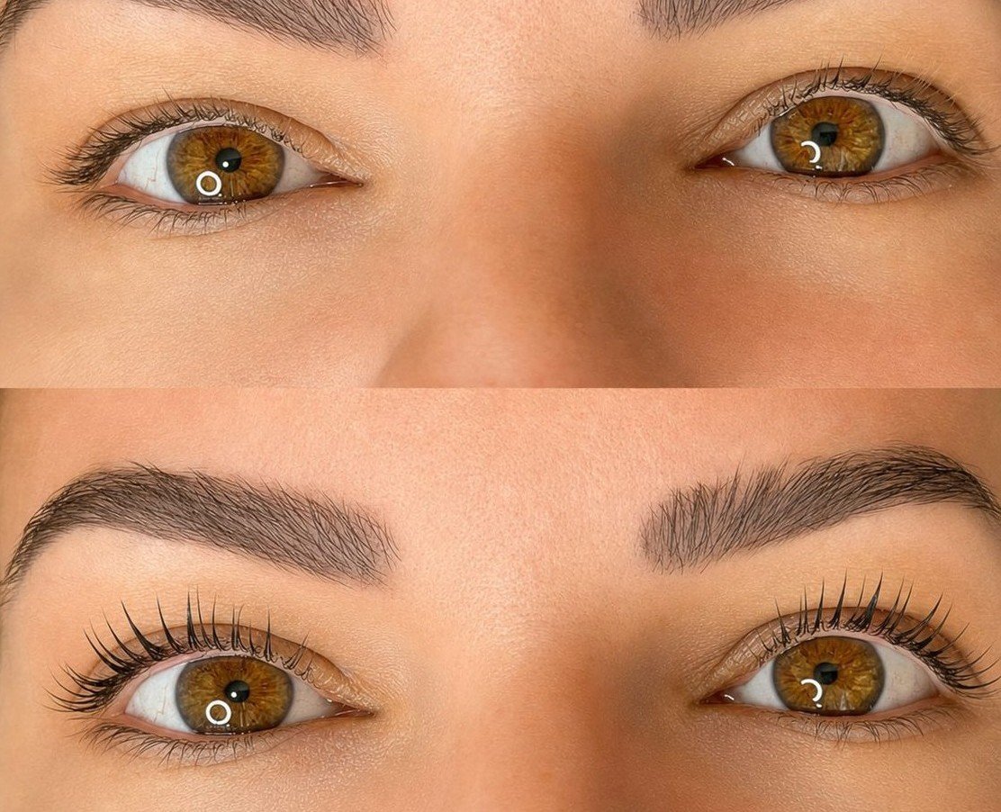 Resultado Keila Martins 2