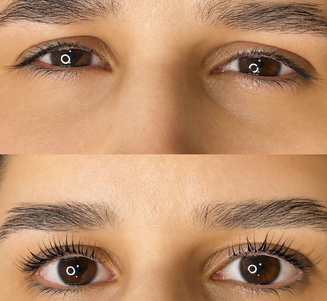 Resultado Keila Martins 1